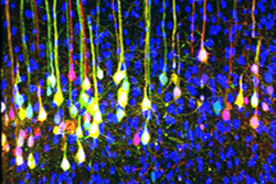This image uses viral tracing to map connected neurons.